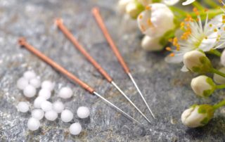 Acupuncture in Houston