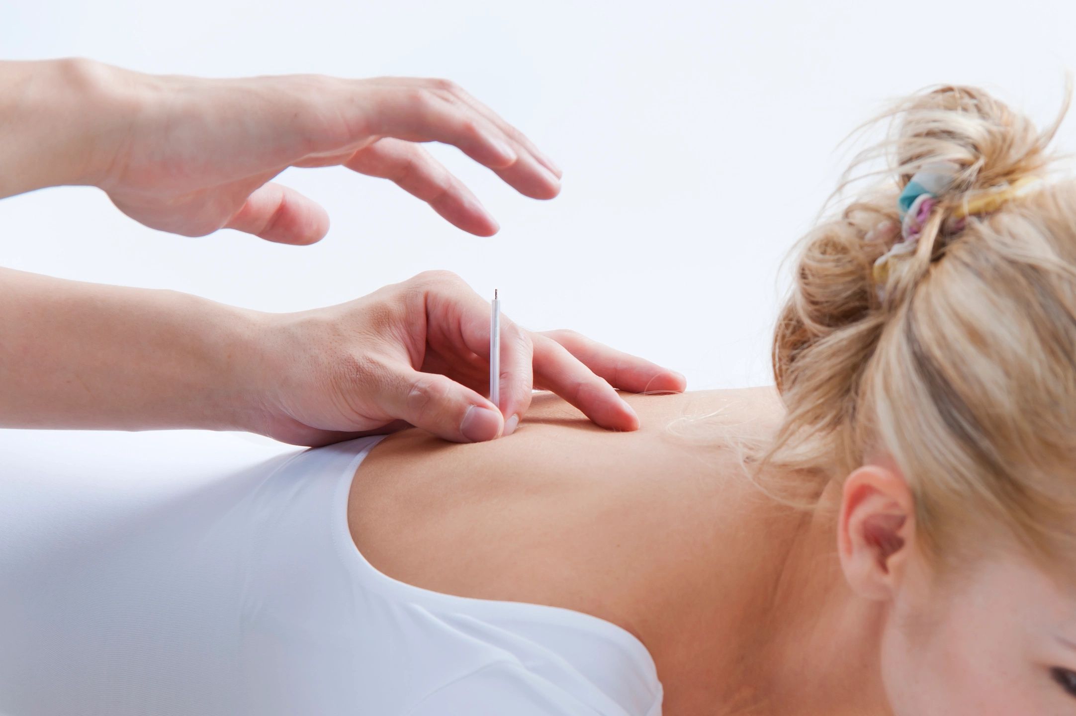 Acupuncture Treatment in Houston