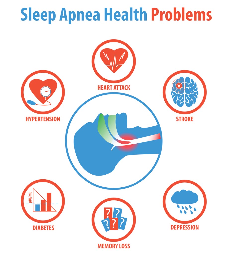 houston-wemed-sleep-apnea-treatments-causes-symptoms-and-health