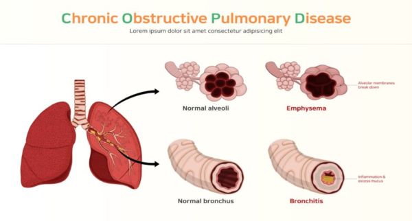 Reverse COPD - weMED Wellness Center of Integrated Medicine