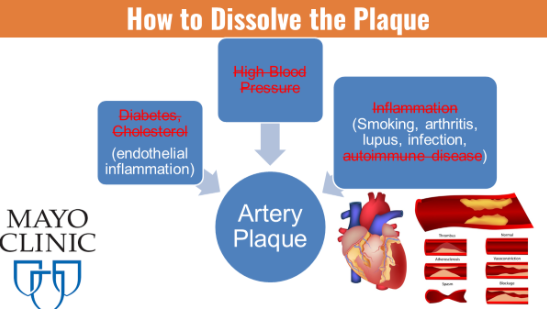 weMED Clinics - The plaque - Artery plaque