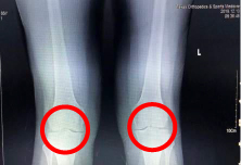 weMED X-rays on the knees , 4126 Southwest Fwy # 1130, Houston, TX 77027, United States