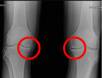 weMED X-rays on the knees , 4126 Southwest Fwy # 1130, Houston, TX 77027, United States