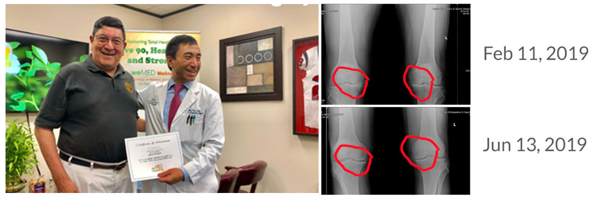 weMED Clinics - knee-case-study